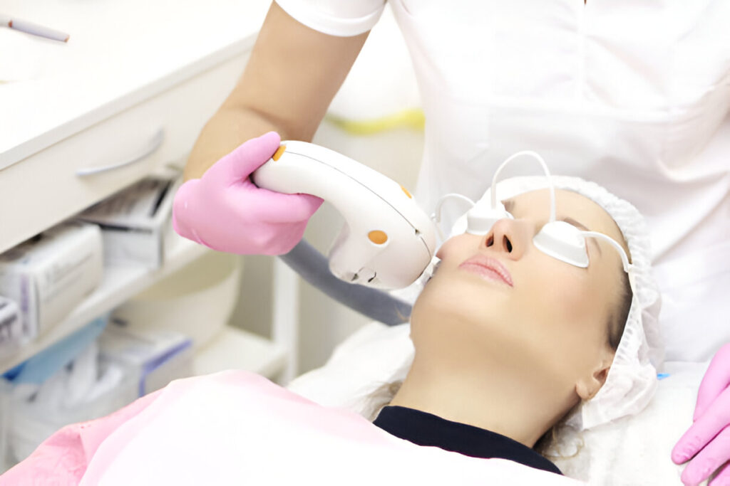 What You Need to Know About Fraxel Laser Treatment