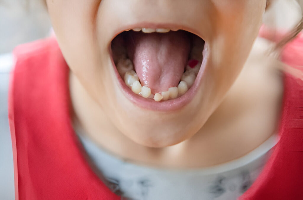 How a Chestermere Dentist Guides the Journey from Baby Teeth to Permanent Smiles